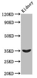 Polyclonal Rabbit anti-Human HOXA4 Antibody (IHC, WB)