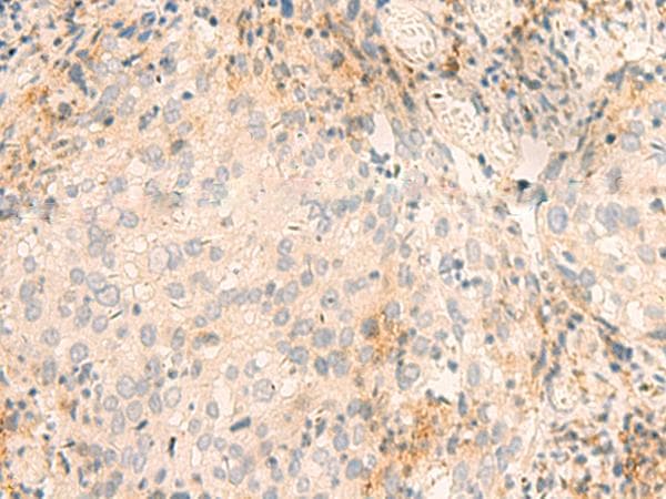 GSKIP / C14orf129 Antibody