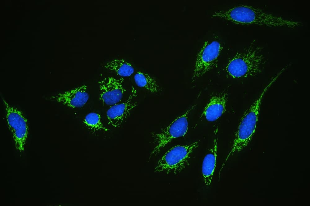 GC1qR / C1QBP Antibody