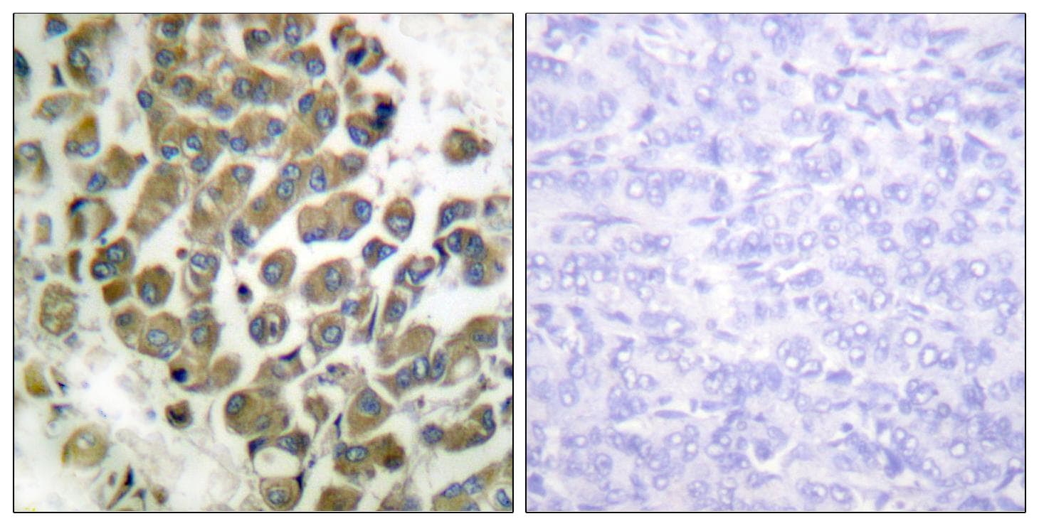 ITGB4 / Integrin Beta 4 Antibody (phospho-Tyr1510)