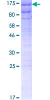 Human SEC63 Protein (Recombinant GST)