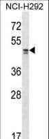 Polyclonal Rabbit anti-Human TADA2L / ADA2A Antibody (aa202-230, WB)