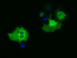 PAICS / ADE2 Antibody (clone OTI5B6)
