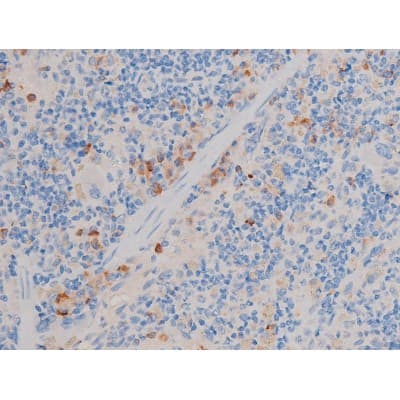 Polyclonal Rabbit anti-Human CDC25A Antibody (phospho-Ser124, IHC, IF, WB)