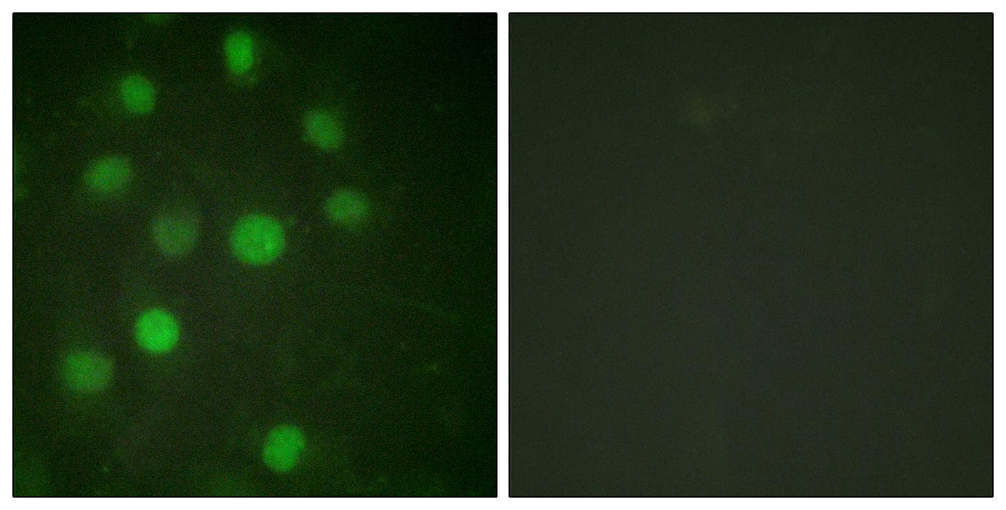 Histone H1 Antibody (p17)