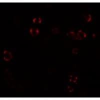 IHC-plus™ Polyclonal Rabbit anti-Human Paralemmin 3 / PALM3 Antibody (IHC, IF, WB)