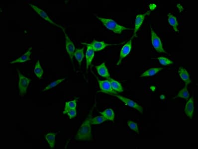 Polyclonal Rabbit anti-Human AGPS Antibody (IHC, IF, WB)
