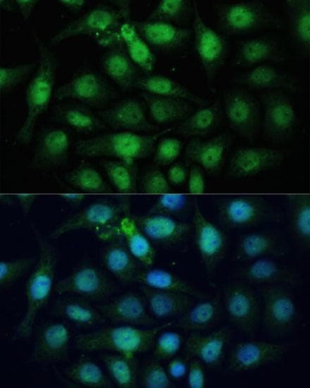 Polyclonal Rabbit anti-Human ZWINT Antibody (IF)