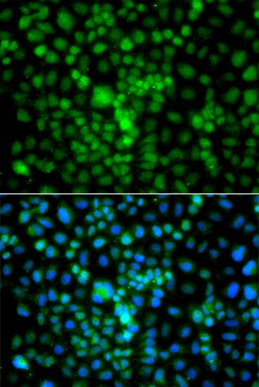 Polyclonal Rabbit anti-Human CIDEA / CIDE-A Antibody (IF, WB)