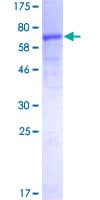 Human CSA / ERCC8 Protein (Recombinant GST)