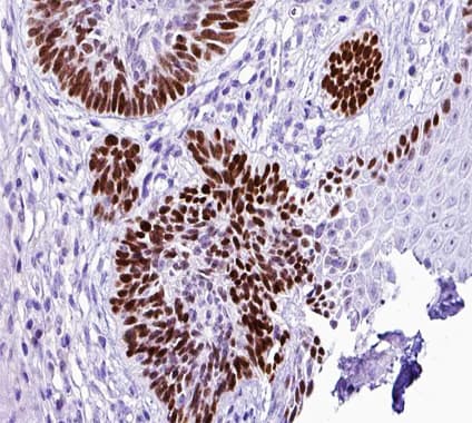 TFAP2A + TFAP2B Antibody