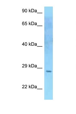 Polyclonal Rabbit anti-Human SOCS2 Antibody (aa117-166, WB)