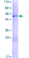 Human DCANP1 Protein (Recombinant GST)