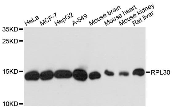 RPL30 / Ribosomal Protein L30 Antibody