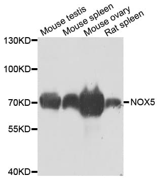 IHC-plus™ NOX5 Antibody