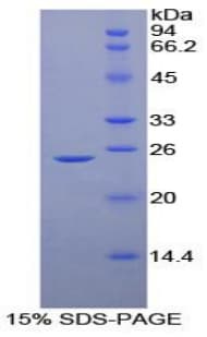 Human CD40L Protein (Recombinant His-S)