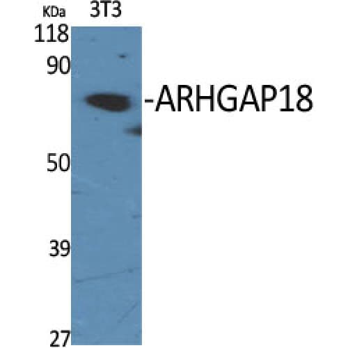 Polyclonal Rabbit anti-Human ARHGAP18 Antibody (490-570 aa, C-terminal, IHC, WB)