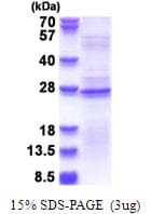 Human RPL18A Protein (Recombinant His)
