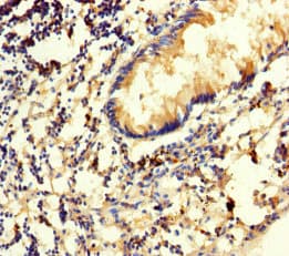 Polyclonal Rabbit anti-Human SRM / Spermidine Synthase Antibody (IHC, WB)