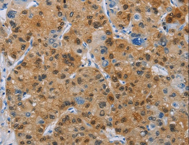 IHC-plus™ Polyclonal Rabbit anti-Human BTLA / CD272 Antibody (IHC)