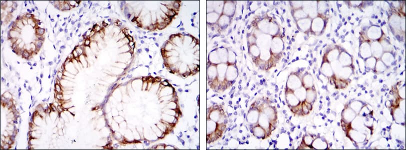 CA9 / Carbonic Anhydrase IX Antibody (clone 2D3)