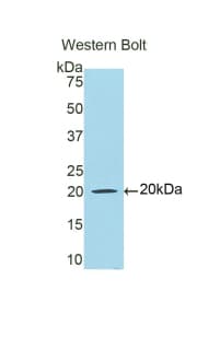 LF / LTF / Lactoferrin Antibody (aa542-685, FITC)