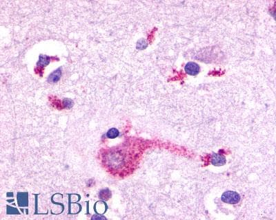PathPlus™ GRM2 / MGLUR2 Antibody (N-Terminus)