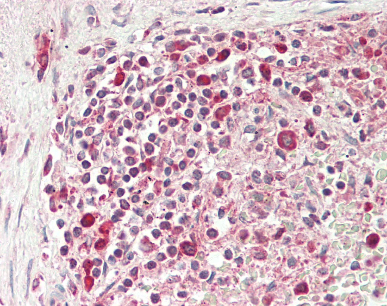 CNOT4 / CLONE243 Antibody (aa36-85)