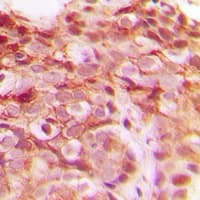 DNAJB4 Antibody (Internal)