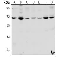 Polyclonal Rabbit anti-Human HSPBAP1 Antibody (WB)