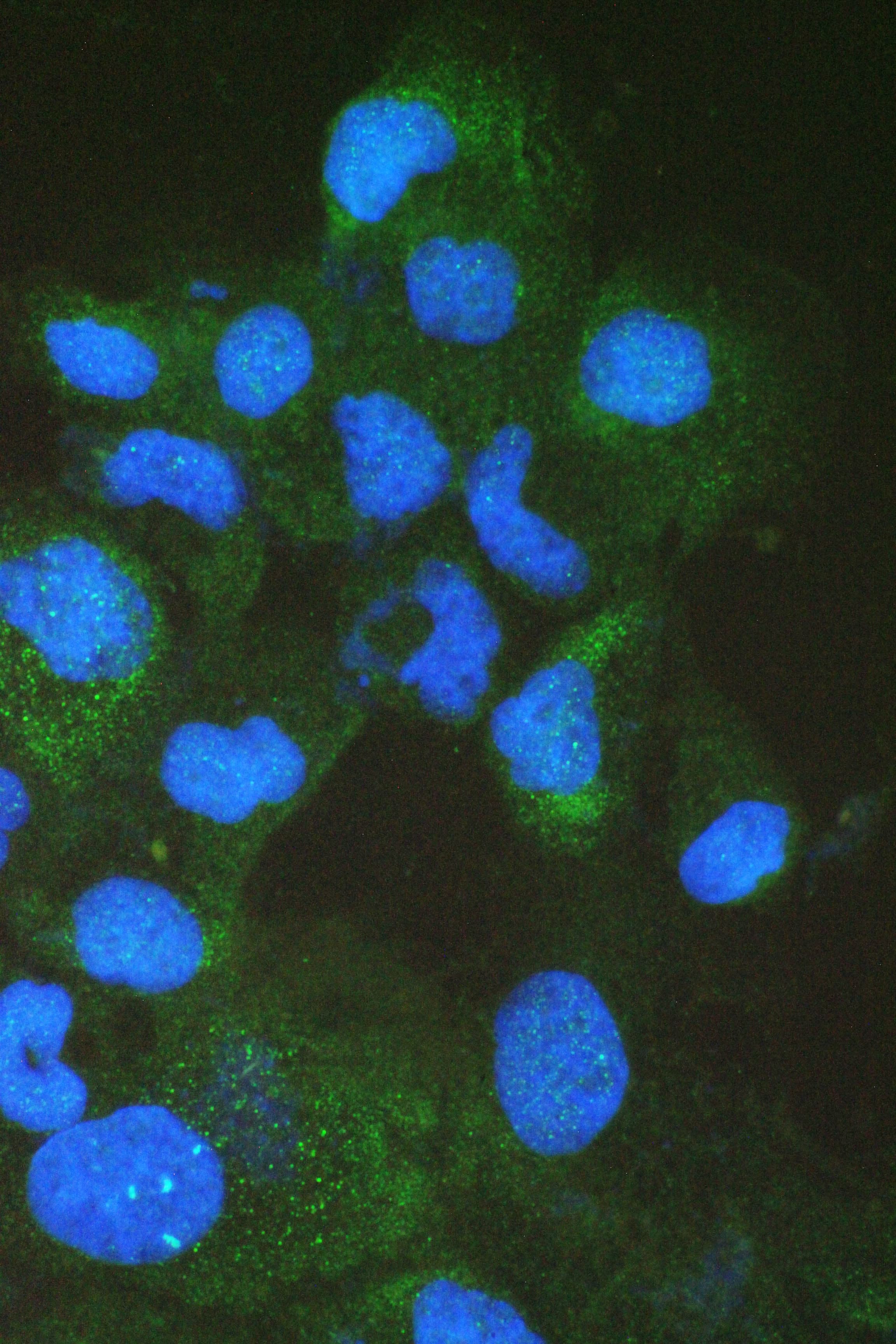 Polyclonal Rabbit anti-Human I-FABP / FABP2 Antibody (IHC, WB)