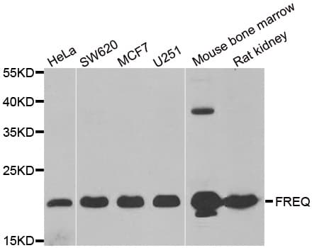 Polyclonal Rabbit anti-Human NCS1 / Neuronal Calcium Sensor Antibody (IHC, IF, WB)