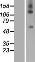 DEPDC1 Protein (Over-Expression Lysate Myc-DDK (Flag))