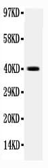 ITGB4 / Integrin Beta 4 Antibody (aa28-266)