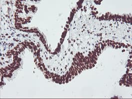 FMR1 / FMRP Antibody (clone OTI1C6)