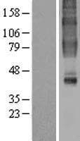 GPR32 Protein (Over-Expression Lysate Myc-DDK (Flag))