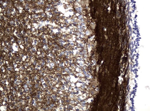 Monoclonal Mouse anti-Human L1CAM Antibody (clone UMAB48, Carrier-free, IHC, IF, WB)