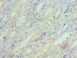 Polyclonal Rabbit anti-Human SERPINA6 / CBG Antibody (aa136-405, IHC)