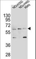 Polyclonal Rabbit anti-Human LILRA2 / CD85h / ILT1 Antibody (aa55-81, WB)