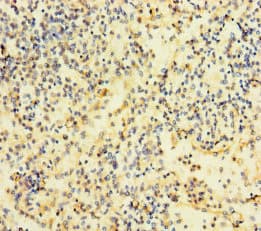 RAC2 Antibody