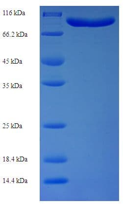 Human MTHFR Protein (Recombinant His-SUMO)