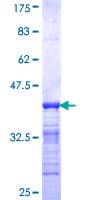 Human IKZF2 / HELIOS Protein (Recombinant GST, N-terminus)