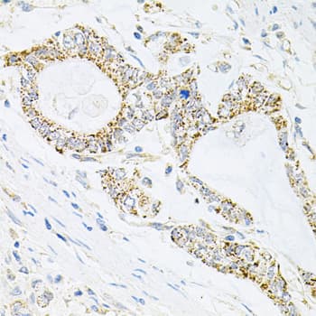 IRS1 Antibody
