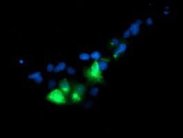 GOLM1 / GP73 / GOLPH2 Antibody (clone OTI2F3)