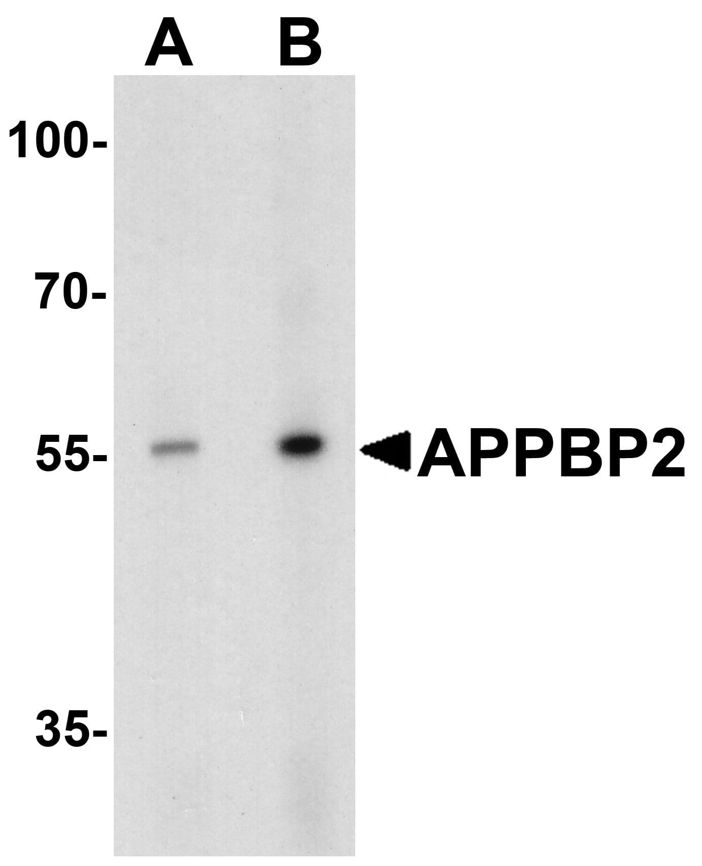 IHC-plus™ Polyclonal Rabbit anti-Human APPBP2 Antibody (IHC, IF, WB)