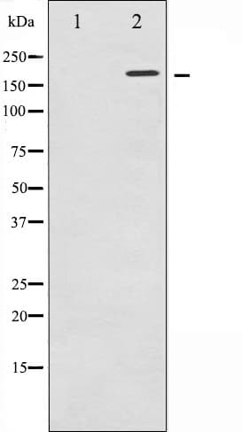 FANCD2 Antibody