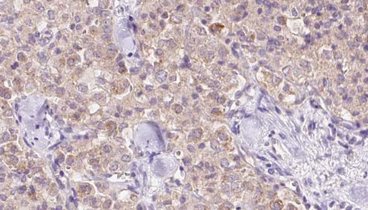 Polyclonal Rabbit anti-Human VPS11 Antibody (IHC, IF, WB)