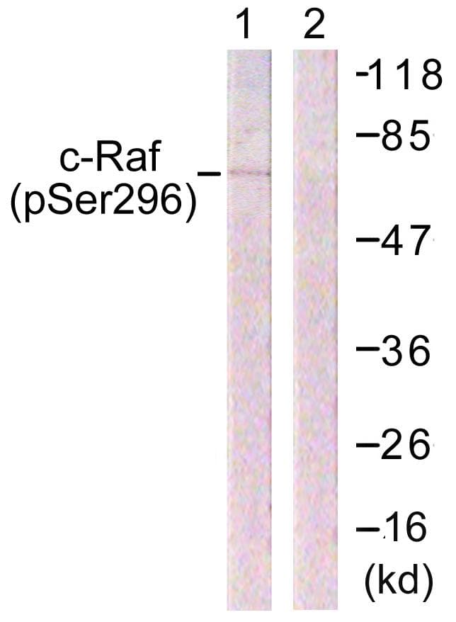 Polyclonal Rabbit anti-Human RAF1 / RAF Antibody (phospho-Ser296, IHC, WB)