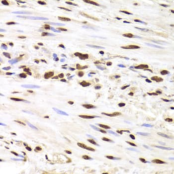 Polyclonal Rabbit anti-Human HNRNPD / AUF1 Antibody (IHC, WB)