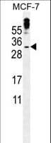 MBD3L3 Antibody (aa156-184)